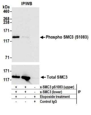 SMC3 [p Ser103] Antibody [NBP2-37694] - Detection of human Phospho SMC3 (S1083) by western blot of immunoprecipitates. Samples: Whole cell lysate (1mg for IP; 20% of IP loaded) from HeLa cells treated with 100 uM EPE for 4 hours (+) or mock treated (-). Antibodies: Phospho SMC3 (S1083) was immunoprecipitated using rabbit anti-Phospho SMC3 (S1083) antibody NBP2-37694 at 6 ug per reaction. Total SMC3 was immunoprecipitated with another rabbit anti-SMC3 antibody. Detection: Chemiluminescence with an exposure time of 10 seconds.